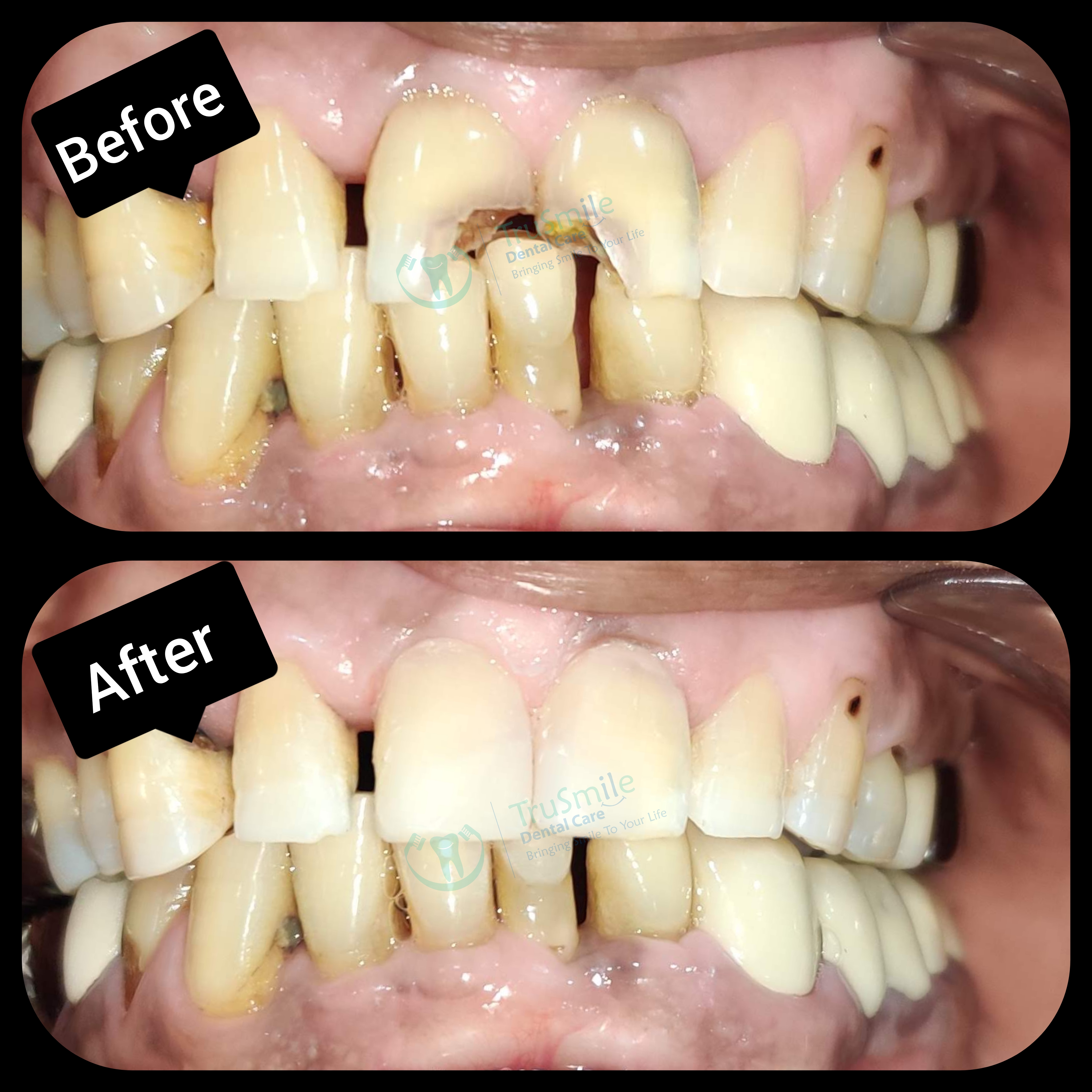 Composite 5